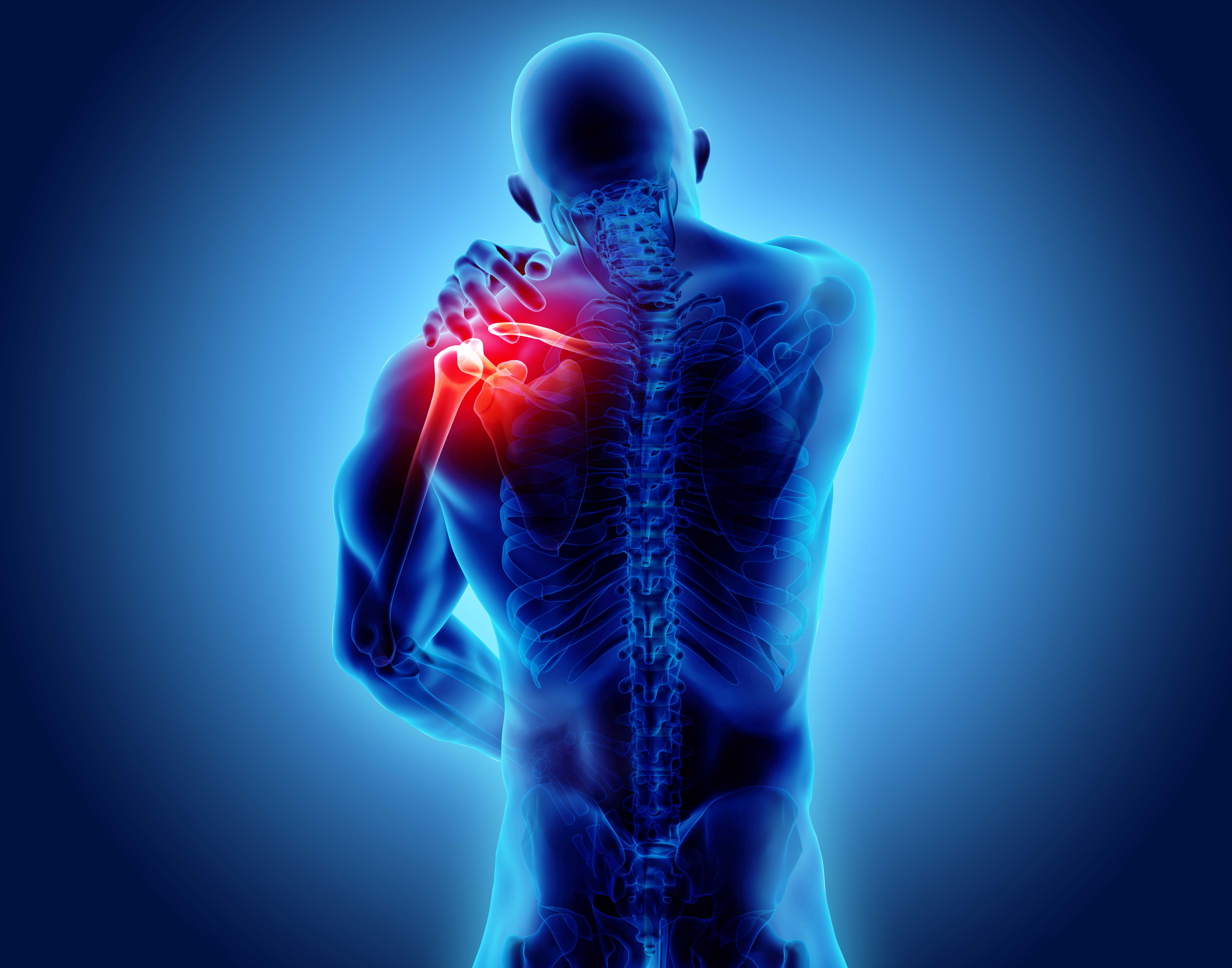 3 Most Common Shoulder Pain Causes And Treatments IPHYSIO Blog